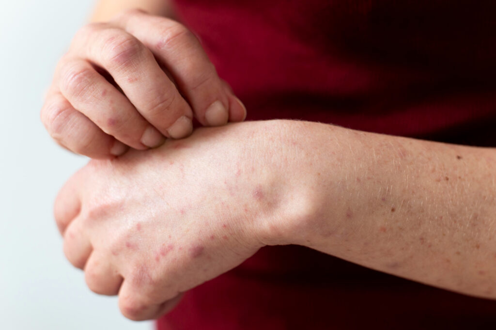 healing skin from inside out