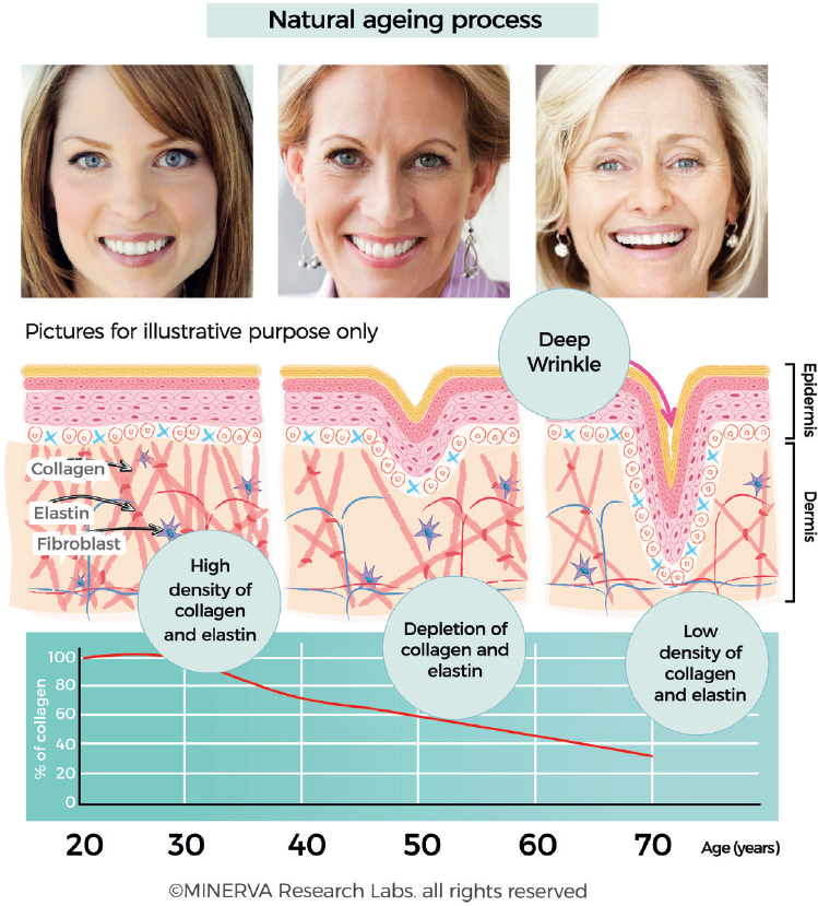 collagen decline
